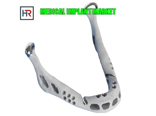 Medical Implant Market.jpg